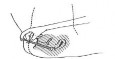 Estrionil